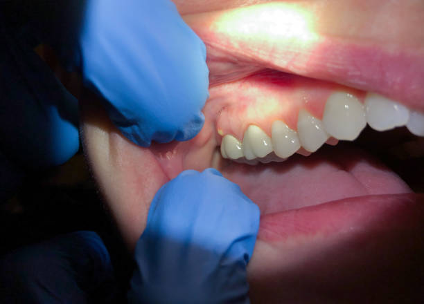 Best Emergency Denture Repair in Lakes Of The Four Seasons, IN